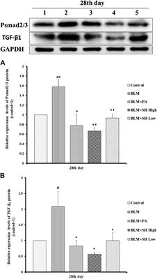 Sodium Houttuyfonate Inhibits Bleomycin Induced Pulmonary Fibrosis in Mice